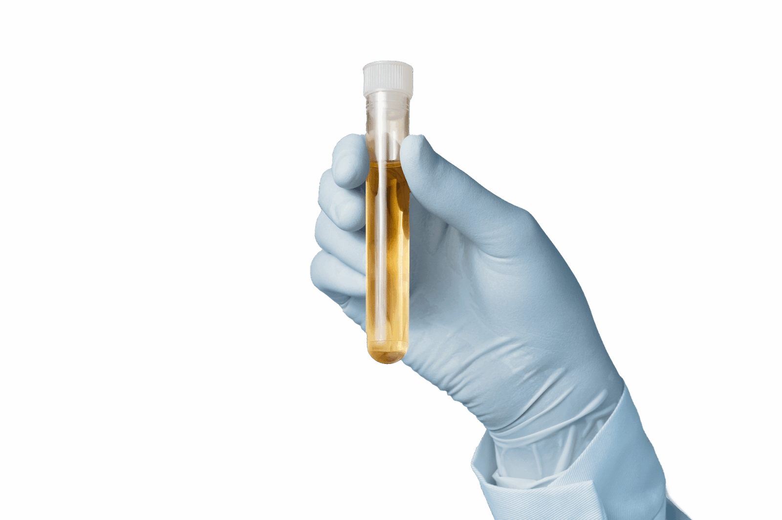 Gloved hand holding urine specimen collection tube